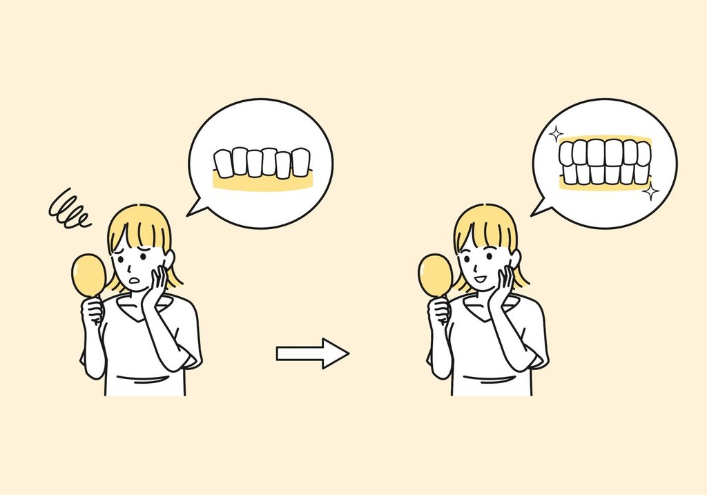 歯並び矯正のビフォーアフターのイラスト