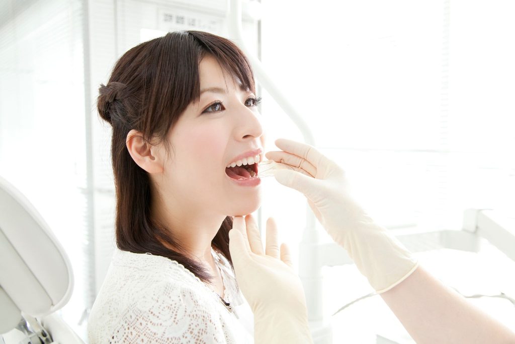 女性の歯にマウスピース矯正装置を装着しようとしている歯科医療従事者
