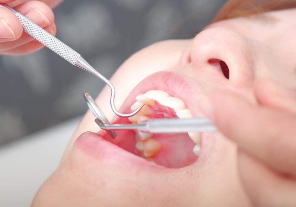 歯科医院で歯をチェックしている様子
